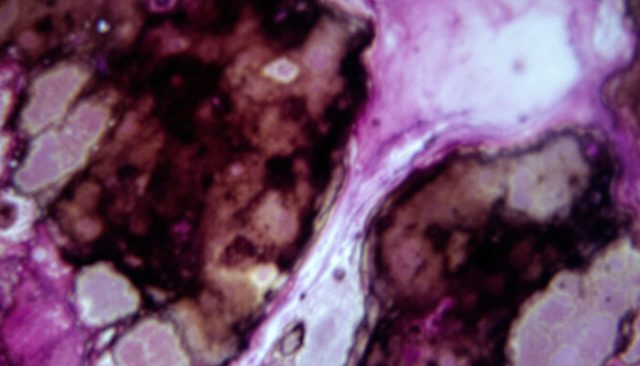 Antibiyotikler: neden Virüslere Karşı Etkisizler ?